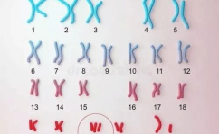 染色体怎么检查,染色体检查的全面解析