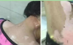 按摩师舌头入侵女顾客,舌头入侵女顾客事件调查